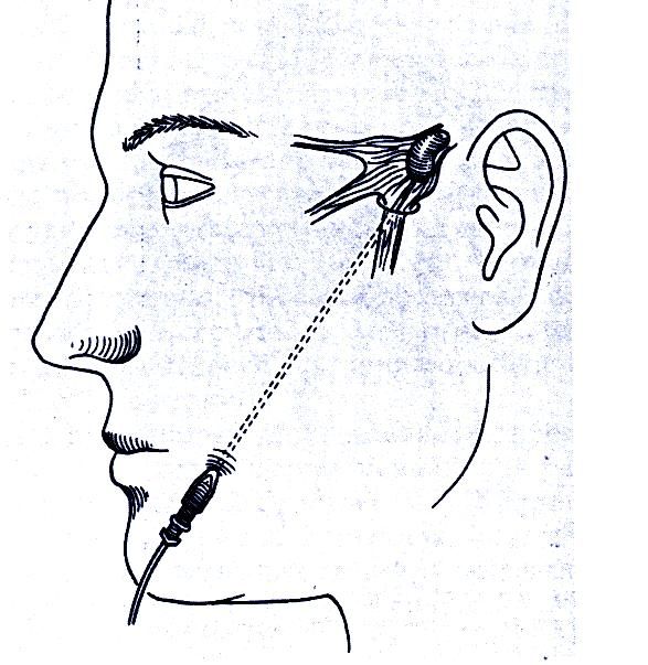 trigeminal 005.jpg